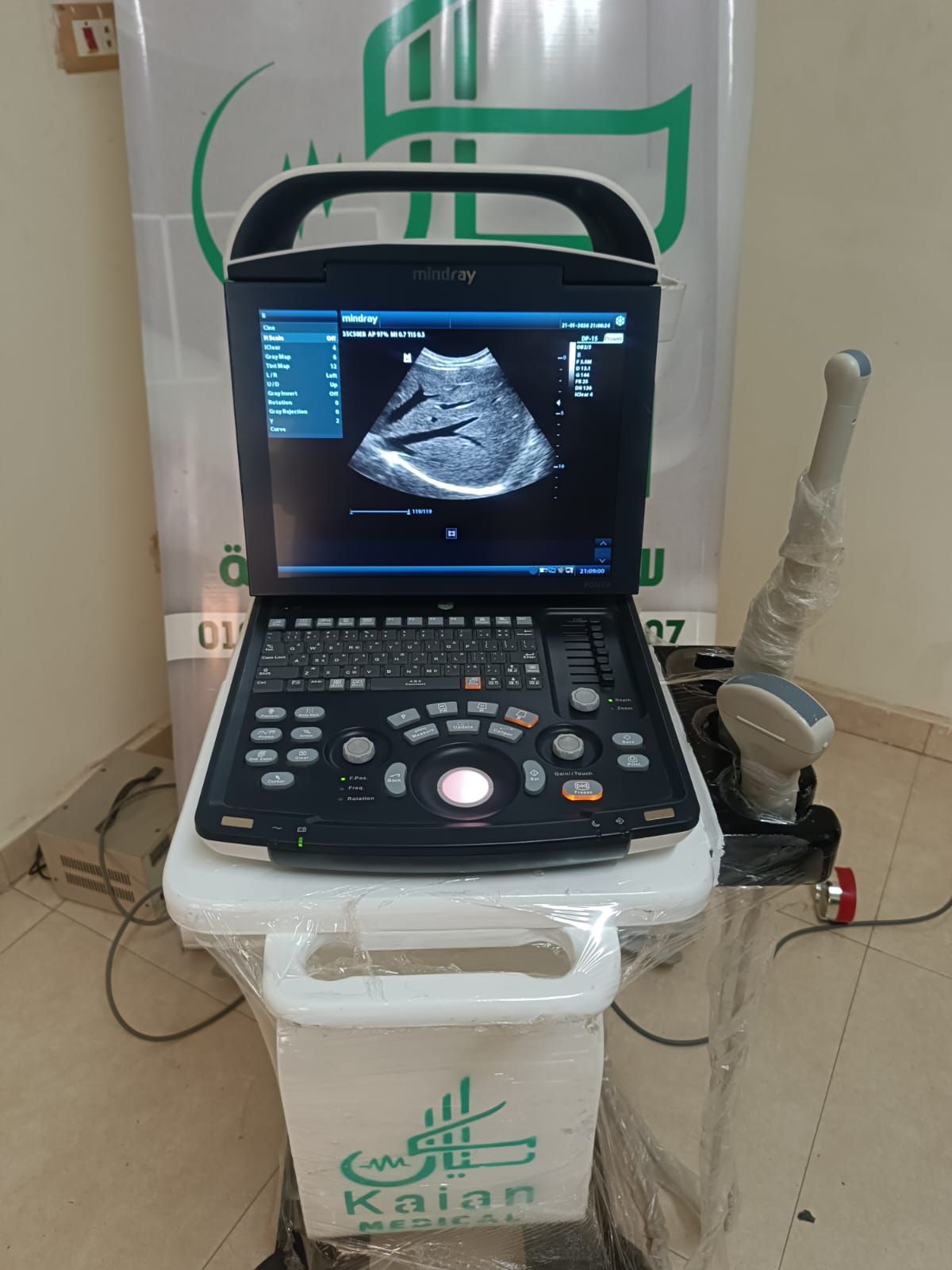 سونار مندراى dp 15