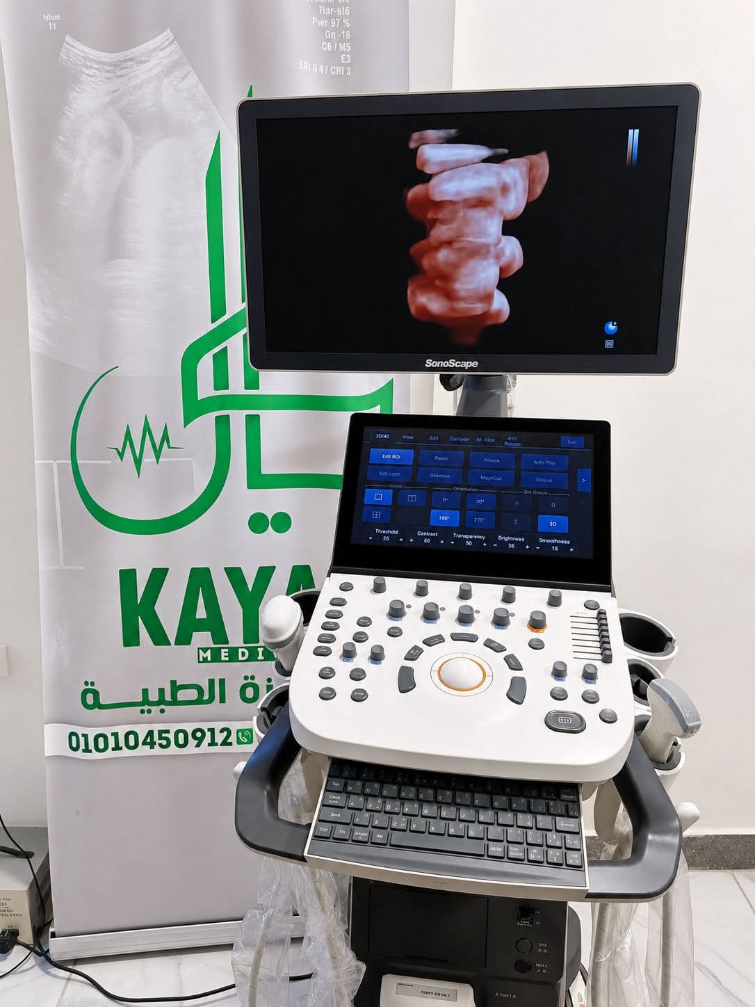 جهاز سونار
