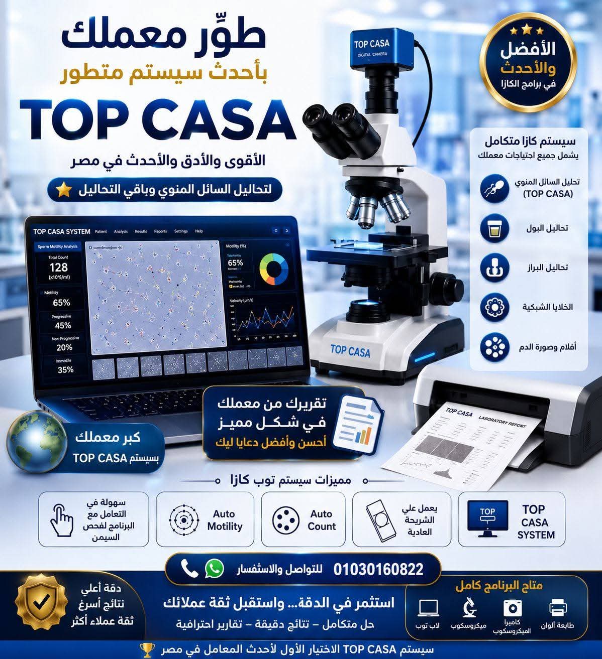 جهاز CASA